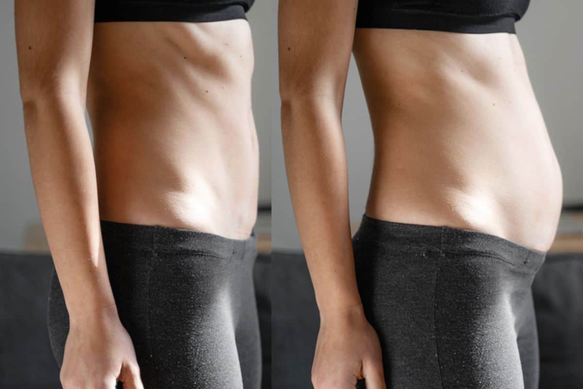 How long does diastasis recti take to improve New Cross?