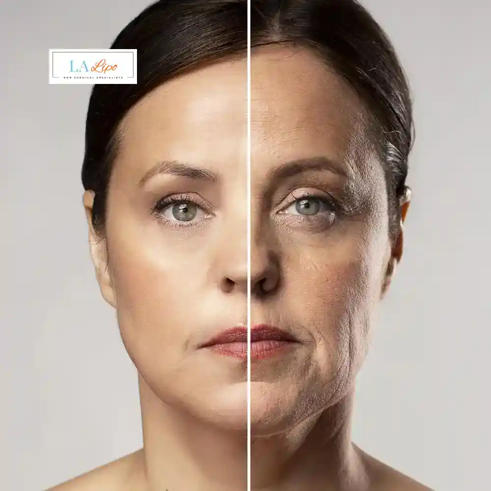 How Can You Tell If Non-Surgical Skin Tightening Is Right for You New Cross?